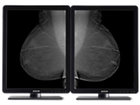 Barco Nio 5MP MDNG-5221