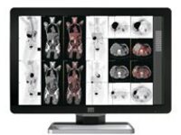 Barco Coronis Fusion 6MP LED MDCC-6230