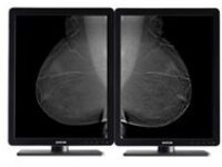 Barco Nio 5MP MDNG-5221