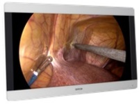 Barco MDSC-8231 LED - LED monitor
