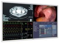 Barco MDSC-8255 - LED monitor