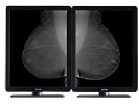 Barco Nio 5MP MDNG-5221