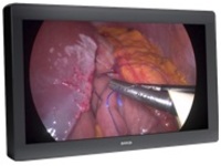 Barco MDFC-8232 3HB - LED monitor