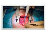 55IN IPS 4K SURGICAL DISPLAY 3480X2160 HDMI DP DVI 12G-SDI