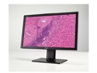 Barco MDPC-8127 - LED monitor