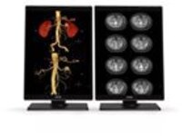 Barco Nio MDNC-3521 - LED monitor