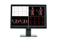 Barco Coronis Fusion 6MP MDCC-6530